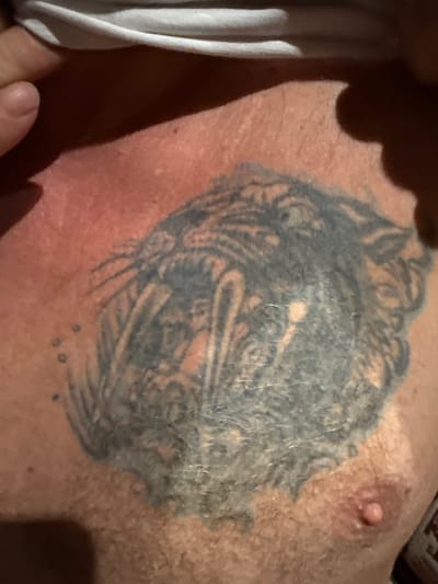 The image shows a close-up view of a person's chest with a tattoo of a snarling animal, possibly a tiger or lion, with sharp teeth and a mane. The tattoo is faded and appears to be old. The skin around the tattoo is reddish, suggesting sunburn or irritation. A white garment is visible at the top of the frame, with a finger pointing from the left edge. The environment appears to be indoors or outdoors with warm lighting. The specific location in the city of Heiligenrode, Germany, is not discernible from the image itself. The image is forensic in nature.