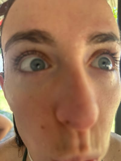 The image displays a very close-up, wide-angle perspective of a person's face, taken in Rio Bueno, Jamaica. The subject is a light-skinned individual with dark brown eyebrows and prominent eyelashes. Both eyes are wide open, featuring light blue irises and dilated pupils, directed straight towards the camera. The skin is visibly wet, with numerous small water droplets scattered across the forehead, around the eyes, on the cheeks, and the nose. The nose is centrally prominent and appears slightly enlarged due to the close-up, wide-angle lens distortion. Several small, dark moles or freckles are visible on the bridge and sides of the nose, and on the cheeks. The mouth is partially visible at the very bottom of the frame. The background is heavily blurred and out of focus, showing indistinct green foliage on the left and upper right, and dark, amorphous structural elements at the top and right, suggesting an outdoor environment.