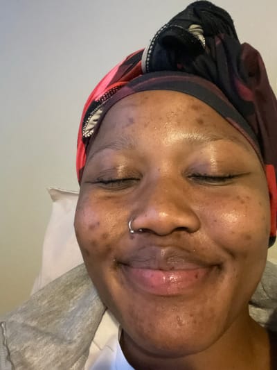 A close-up, low-angle selfie features a Black person with their eyes closed and a slight smile. They are wearing a headscarf with a red, black, and white pattern. A silver hoop is visible in their septum piercing. The person's skin shows some texture and discoloration. They are wearing a grey hooded sweatshirt and a white t-shirt underneath. The background is a plain, light-colored wall and a pillow. The image does not contain information about a specific location in Randburg, South Africa.