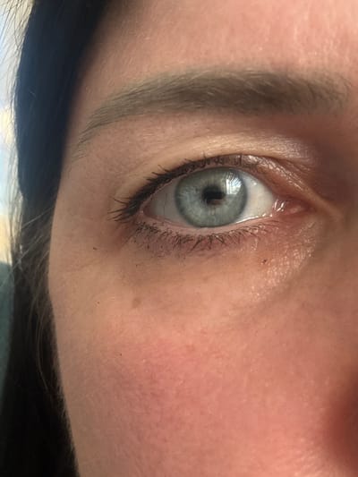 The image is a close-up, head-and-shoulders portrait of a person's right eye and surrounding facial area, taken from a frontal perspective. The eye is light blue with a dark pupil. The skin is fair, with visible pores and some redness on the cheek. The eyebrows are dark and well-defined. Eyelashes are dark and appear to have mascara applied. There are small dark specks, possibly debris or mascara fallout, on the lower eyelid and cheek. The background is blurred and consists of dark hair on the left side and a light, out-of-focus area to the right. There is no identifiable information about the location being Dubovoye, Russia.