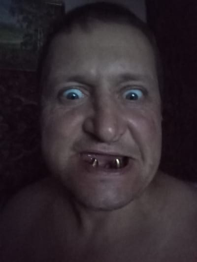 A close-up, low-light, head-and-shoulders selfie shows a man with his mouth open, revealing two gold rings between his teeth. His eyes are wide open and looking directly at the camera. The background is dark, with a hint of what appears to be a landscape painting on the left side. The image quality is grainy, suggesting it was taken with a low-resolution camera or in poor lighting conditions. The man's skin appears somewhat weathered. There are no discernible elements in the image that can be used to identify the location as Suklieia, Moldova.