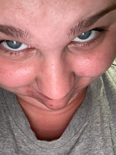 The image is a close-up, upward-angled, selfie-style photograph of a person's face, focusing on their eyes, nose, mouth, and chin. The subject has pale skin with visible pores and some redness on the cheeks. Their eyebrows are dark and somewhat bushy, and their eyes are a light blue-grey color, looking directly at the camera. The mouth is pursed, with a slight smirk. The person is wearing a grey t-shirt. The lighting appears to be artificial, casting some shadows and highlighting the texture of the skin. There are no visible contextual elements to suggest a specific location within Acones Dārzs, Latvia.