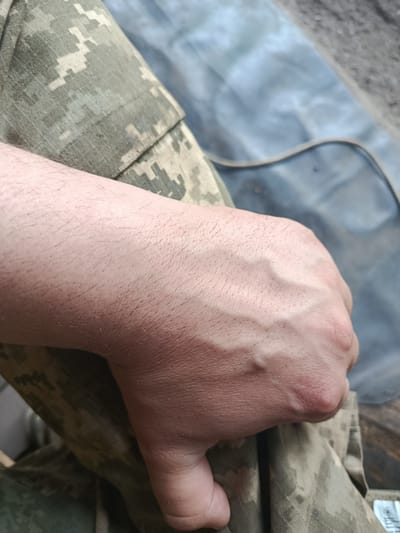 The image shows a close-up view of a person's forearm and hand, resting on a piece of camouflage fabric. The skin on the forearm is lightly haired, and prominent veins are visible on the back of the hand, suggesting the person may be exerting themselves or experiencing increased blood flow. The hand is slightly clenched. The camouflage fabric appears to be part of military-style clothing, with a pixelated pattern of greens, browns, and blacks. In the background, a blurred, dark, possibly plastic or tarp-like material is visible, with hints of a rough, textured surface, possibly wood. The lighting is diffused, indicating it is likely daytime, but the exact time and weather conditions are not discernible. There is no visible text in the image. The context of Dubno, Ukraine, suggests the scene might be related to military activity or personnel. The overall mood is neutral and observational.