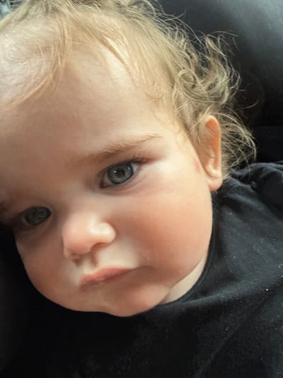 The image is a close-up, low-angle shot of a young child's face. The child has fair skin, light blonde curly hair, and blue eyes. The left eye is partially obscured by shadow. The child is wearing a black shirt. The background is dark and out of focus. There is a small red mark on the child's cheekbone, near the left ear. The image appears to have been taken indoors. The city of Schwalbach, Germany is not visible in this image.