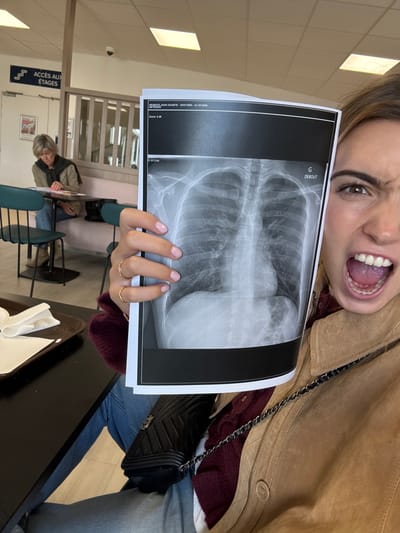 The image depicts an indoor waiting area, likely within a medical facility, located in Saint-Priest, France.

In the foreground, a young adult female's right side is visible, holding a printed chest X-ray film directly towards the camera with her left hand. She has light-colored hair, a visible right eye, and her mouth is wide open in an exaggerated expression. She wears a tan-colored jacket over a maroon top and blue jeans. A black quilted shoulder bag with a silver chain strap is visible on her left side. Her left hand has light pink nail polish and two gold rings on the ring finger. The X-ray film displays a frontal view of a human chest, with text at the top indicating "PEREIRA JOAO DUARTE - 29/07/2005 - 23:15:290", the word "DEBOUT" (French for 'standing'), and the partially visible word "DISGUT".

In the background, an older adult female with short grey hair is seated at a table. She wears a light brown jacket over a dark scarf and is observed looking down at an item on the black tabletop, possibly engaging with paperwork. She is positioned on a light pink upholstered bench, with green-backed chairs nearby.

The environment features a white ceiling with square fluorescent light panels. A small security camera is mounted on a ceiling beam. On a wall to the left, a blue sign with white arrows points upwards and reads "ACCES AUX ÉTAGES" (Access to Floors). A light-colored, vertically slatted partition separates the foreground from the background seating area. In the immediate lower-left foreground, a brown tray holds white napkins or paper on a black table.