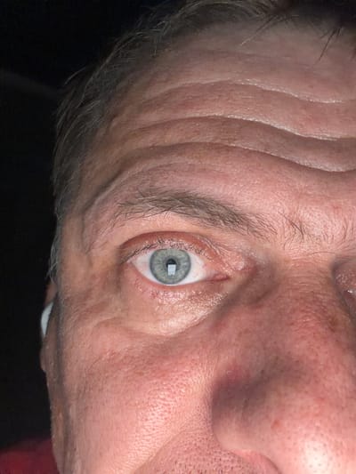 A close-up, low-angle, outdoor, night photograph shows the left eye and forehead of a Caucasian male. The subject is facing forward and slightly to the left. His eye is light blue with a visible pupil. The skin on his forehead exhibits deep wrinkles, and his eyebrow is sparse. The background is dark, suggesting a low-light environment, possibly an outdoor setting in Wildwood, United States, as indicated by metadata. A faint reflection of a light source is visible in the subject's pupil. The subject is wearing what appears to be a white wireless earbud in his left ear.