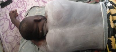 In an indoor setting within the city of Agunmo, Nigeria, one individual is depicted in a prone position, lying face down on a mattress covered by purple and white patterned sheets. The person, an individual with dark skin and short dark hair, has their head turned to the left, with their left arm bent and partially visible near their head. A significant portion of their back, shoulders, and the back of their neck is coated in a light-colored, powdery or pasty substance, appearing white or light gray and applied unevenly. The individual is partially covered by a yellow, black, and white patterned fabric around their lower torso. A black rectangular object, consistent with a smartphone, rests on the patterned mattress in the upper left quadrant of the image. No visible actions or interactions are occurring beyond the individual's stationary pose.