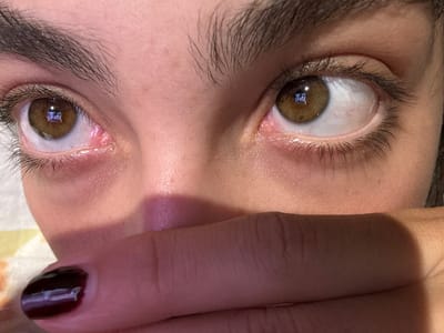 The image shows a close-up view of a person's face from a low angle. The person's eyes are looking upward, with brown irises reflecting a screen. The person's eyebrow is visible. A hand is partially obscuring the forehead. The fingernail is painted dark purple. The image does not include any information pertaining to Mata de Uva, Mexico.