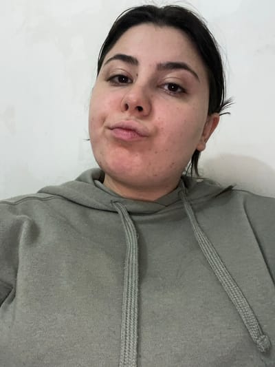 The image displays a close-up portrait of a young adult female, reportedly located in Talin, Armenia. The subject is centered, looking directly at the camera with her lips pursed in a "duck face" expression. She possesses dark hair, dark eyes, and prominent eyebrows. Her skin exhibits minor blemishes, including a small mole on her left cheekbone and faint freckles. She is dressed in a light olive-green or grayish-green hooded sweatshirt, with the light-colored, ribbed drawstrings visible around the neckline. The background consists of a plain, light-colored wall, likely white or off-white, which appears to have minor textural irregularities.