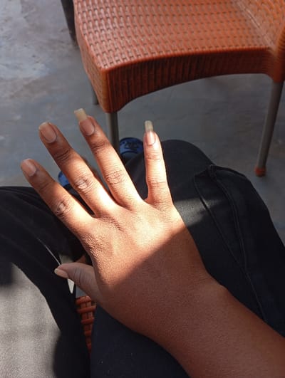 A human left hand with medium brown skin is positioned in the foreground, resting on a lap covered by dark-colored trousers. The nails on the index, middle, ring, and pinky fingers are notably long and appear unmanicured, with the index and middle finger nails exhibiting a yellowish-off-white discoloration. Strong sunlight illuminates the upper portion of the hand and leg, casting a distinct shadow across the lower hand and wrist. In the background, part of an orange-brown, woven plastic chair with metallic legs is visible. The ground beneath the chair is a light-colored surface, likely concrete, with a glimpse of blue footwear visible. The scene is located in Kofar Ruwa, Nigeria.