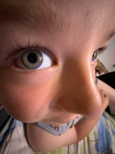 A close-up, low-angle shot shows the face of a child with fair skin and light brown eyebrows. The child's left eye is open and clearly visible, with a green iris and dark pupil. The right eye is partially visible. The child is looking upward and slightly to the left. The foreground is dominated by the child's cheek, nose, and forehead. The background is blurred and appears to show bedding with a striped pattern in green, white, and blue. The image does not provide any information about the city of Zmeitsa, Bulgaria.