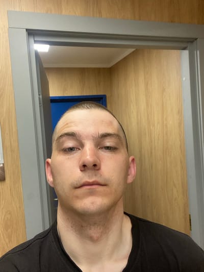 A front-facing portrait photograph captures an adult male from the upper chest upward. The individual has a closely shaven head, light-colored eyes, and a neutral expression; a minor abrasion is visible on the left side of his forehead. He is wearing a dark, plain crew-neck t-shirt. The subject is positioned within a gray-framed doorway. The surrounding walls are covered with light wood-grain paneling. Through the open doorway, a room is visible featuring a white ceiling with a square, flush-mounted light fixture and a partial view of a blue door or wall in the background. The specific location within Марфино, Russia, is not identifiable from the image.