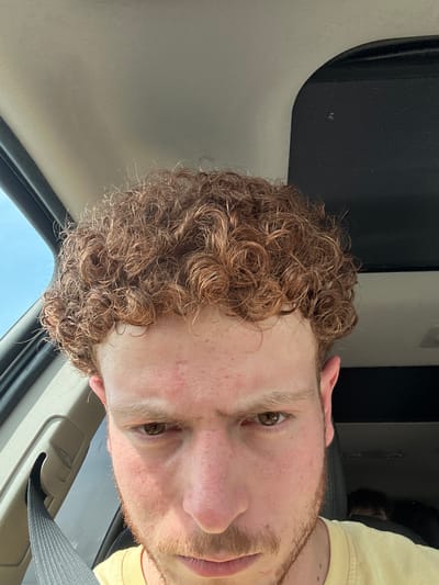 This close-up, sideways portrait features a young adult male positioned within what appears to be a vehicle interior. The man has fair skin, light brown eyes, and a prominent head of light brown, curly hair. He also has short facial hair, resembling stubble or a light beard. Areas of redness are visible on his face, particularly on his cheeks and forehead. He is wearing a yellow shirt, partially visible on the right side of the frame.
The background confirms the setting as a car or truck, with a gray fabric headliner and a dark panel visible above and behind his head. Through a window in the lower part of the image, a bright, clear blue sky is visible, suggesting it is daytime with sunny weather. A gray seatbelt is also present in the lower right, reinforcing the vehicle setting.
The man is looking directly at the camera with a neutral expression, indicating he is posing for the photograph. No specific activity beyond this is taking place. The time of day is clearly daylight, as evidenced by the bright, unobstructed sky. There is no visible text in the image.
Location context: Ridgefield, United States of America.
