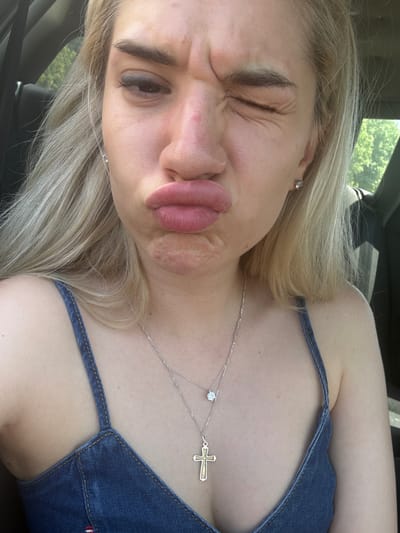 A young blonde woman is depicted in a close-up, chest-up portrait, making an exaggerated facial expression. She has light skin with visible pores and some minor redness or blemishes on her nose and chin. Her lips are pursed forward in a "duck face," and her right eye (viewer's left) is completely closed in a wink, while her left eye (viewer's right) is squinted, causing wrinkles around the eyes and forehead. She wears a blue denim-style top with thin straps and two silver-toned necklaces; one with a small clear gemstone pendant and another with a gold-colored cross pendant. A silver stud earring is visible in her right ear (viewer's left). The background suggests she is inside a vehicle, possibly a car, with dark interior elements visible behind her. Through a window, green foliage (trees) is visible under bright, natural lighting. The image does not contain any visual information to specify the location as Novo Konjarevo, North Macedonia.