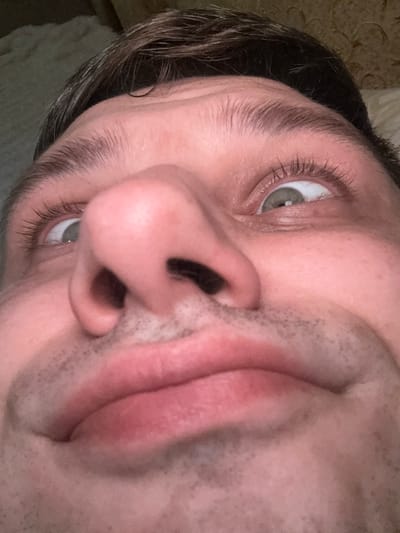 This is a close-up, low-angle selfie of a person's face. The subject's head is tilted upwards, and the camera is positioned below their chin, looking up towards their eyes. The focus is on the nose, mouth, and eyes, with the forehead and hair visible at the top of the frame. The skin tone is fair, and there are visible pores and some facial hair around the mouth. The eyes are open and looking upwards and to the side. The lighting appears to be indoor and possibly dim, casting shadows on the face. The background is blurred and suggests an indoor environment, potentially a bedroom with textured wallpaper and bedding. There is no discernible connection to the city of Berdychiv, Ukraine, as the image lacks any identifiable landmarks or contextual clues.