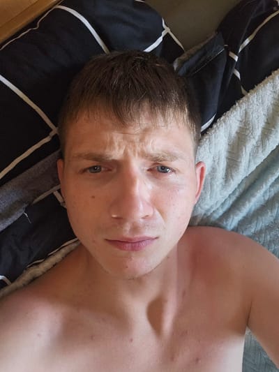 The image is a close-up, overhead shot of a fair-skinned individual lying down. The person has short, light brown hair, blue eyes, and is looking directly at the camera with a concerned or confused expression. Their eyebrows are furrowed, and their mouth is slightly open. The individual appears to be shirtless, revealing their shoulders and upper chest, which show some minor blemishes.
The background consists of bedding. To the left, a dark pillow with white diagonal stripes is visible. To the right, a light blue, textured blanket or sheet is present. The lighting suggests an indoor setting, possibly a bedroom.
There are no clear indications of the location within Dūkštas, Lithuania, or any specific urban environment. The scene is domestic and personal.