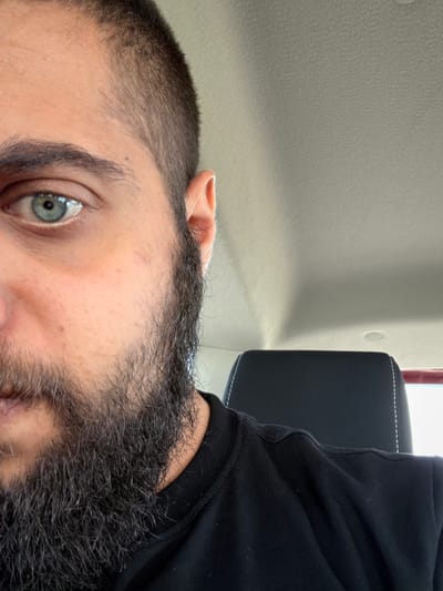 A close-up, left-facing shot shows the left side of a person's face and head, including their eye, beard, and part of their ear. The eye is a striking blue-green, with dark eyelashes and eyebrows. The skin is light-toned with some visible pores and a few small blemishes. A thick, dark beard covers the lower part of the face, extending down the neck. The person's hair is short and dark, with a buzz cut on top. The background consists of the light-colored interior of a vehicle, with a black headrest visible behind the person. The lighting is bright, suggesting daytime. The location in Nedyalsko, Bulgaria, is not evident from the image.