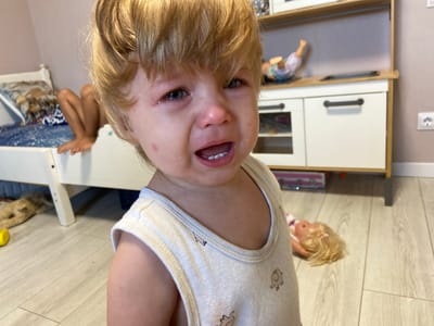 A close-up, eye-level shot shows a young Caucasian child with blonde hair crying intensely. The child's eyes are wide and tearful, with visible tears streaming down their cheeks. Their mouth is open in a wail, revealing their teeth and tongue. Red marks, possibly scratches or rashes, are visible on the child's face, including one on the left cheek and another near the eye. The child is wearing a sleeveless, light-colored shirt with a pattern of small elephants.
In the background, a white bed with a blue and patterned mattress is visible on the left. A child's legs and feet, likely belonging to another child, are positioned on the bed, partially obscured. To the right of the child in the foreground is a white and wood-toned toy kitchen playset. A doll with blonde hair lies on the floor in front of the playset. The floor appears to be light-colored wood laminate. The environment seems to be an indoor residential setting, possibly a bedroom or play area, in a city such as Fadeyevo, Russia. The overall impression is one of distress and upset.