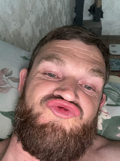 The media file is a close-up, low-angle selfie of a person lying down. The subject has light skin, a beard, and is looking directly at the camera with a pouty expression. They have wrinkles on their forehead and around their eyes. The background appears to be a patterned surface, possibly a pillow or bedding, with floral motifs. To the left of the subject, there is a blurred background with what looks like furniture or objects in a room. The lighting suggests it could be indoors, possibly during the day. No text is visible in the image. The setting is likely a bedroom or living space in Chituk, Russia.