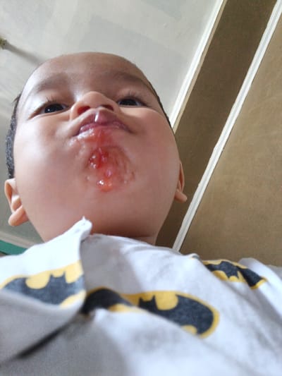 A low-angle, close-up shot captures the face of a baby, looking upwards. The baby's mouth is open, with a clear, viscous liquid pooling around it and on its chin. The baby is wearing a white t-shirt adorned with the iconic yellow and black Batman logo. The background consists of a ceiling and a wall with decorative trim. The lighting suggests an indoor environment. The image appears to be a personal photograph taken in Cibungbulang, Indonesia.