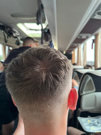 A close-up, angled shot captures the back of a person's head with short, light brown hair. A small, red, oval-shaped object rests on the back of their neck. The scene appears to be inside a bus or train, with white overhead compartments visible. Other passengers and luggage are partially visible through the window and aisle. There's no specific indicator this is in Villafranca di Verona.