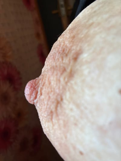 The image is a close-up, extreme macro photograph of a human nipple and areola, specifically showing the texture of the skin and the nipple protrusion. The background is out of focus, with a patterned fabric on the left and a dark area on the right. There are no discernible geographical markers or indications of the city of Zhirnov, Russia, within the image.