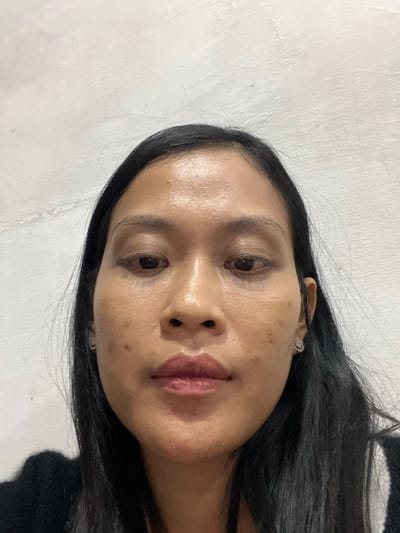 A close-up, head-on shot shows the face of a woman with long, dark hair against a white, textured wall. The woman's face is illuminated, highlighting an oily complexion and some blemishes. She has dark eyes and appears to be wearing subtle makeup. Small, sparkly earrings are visible in her earlobes. Her mouth is slightly open, with her lips appearing to be tinted. The background is a plain, off-white wall with visible imperfections and texture. There are no discernible objects or actions occurring in the scene, beyond the static pose of the subject. The overall impression is a candid portrait, with no specific environmental context beyond the wall.
