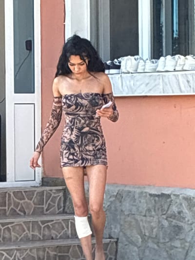 A young woman with long, dark, wavy hair is depicted walking down a set of outdoor steps in Radievo, Bulgaria, during daylight hours. She is wearing a strapless, short dress with detached long sleeves, both featuring an intricate dark pattern on a lighter background. Her head is tilted downwards, and she is looking at a white smartphone held in her left hand. Her right knee is wrapped with a white bandage, and minor abrasions are visible on both legs. The background consists of a building with a peach-colored exterior wall. To the woman's left, a white-framed glass door or tall window is visible. To her right, a white-framed window is present, beneath which a ledge holds several white objects, possibly shoes. The steps are constructed from grey, irregularly shaped stone tiles, and a lower wall of rough, grey stones is visible at the bottom right.