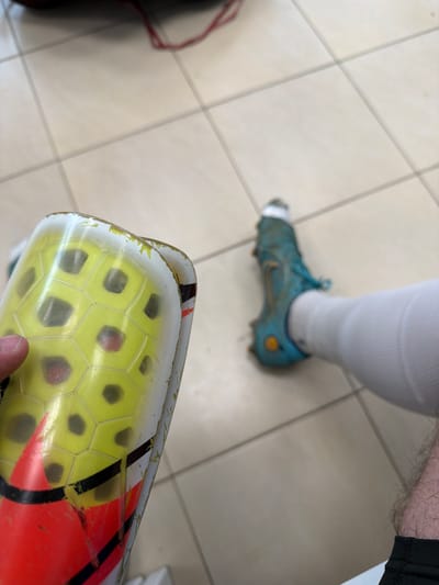 The scene depicts an indoor setting, most likely a changing room or facility associated with sports, indicated by the light-colored tiled floor and athletic equipment. A person's right leg is visible, clad in a white athletic sock and a dirty blue-turquoise soccer cleat. The lower portion of the leg above the sock shows body hair. In the foreground, a right hand holds a worn soccer shin guard. The shin guard is predominantly yellow with a honeycomb pattern under a translucent outer layer, showing significant wear, chipping along its white and red edges, and a partial red Nike swoosh logo. A blurred red strap or cord is visible in the upper background. The specific location within Suvorovo, Bulgaria, cannot be determined from the visual evidence.