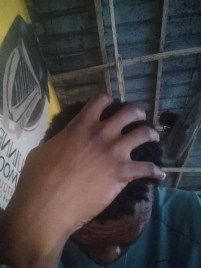 A person's hand is obscuring their face in this upshot. The person has dark hair and is wearing a turquoise shirt. In the background, there is a Guinness poster on the wall and a wooden ceiling. The fan is on. The lighting is subdued and creates a slightly muted effect.
