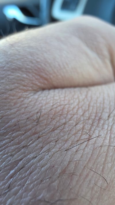 A close-up shot of human skin with sparse hairs. The skin appears light-colored, with wrinkles and texture visible. In the background, partially out of focus, are indistinct objects that suggest an interior setting. There is no evidence to suggest a location in the city of Heusden, Belgium.