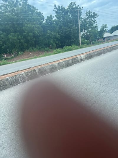 The media file shows an outdoor scene with a road and vegetation. A portion of the right side of the image is blurred due to a thumb obscuring the camera lens. The road appears to be paved and has a textured surface. Along the side of the road, there is a curb made of concrete blocks filled with gravel. Beyond the curb, there is a strip of dry earth and then lush green trees. A power pole with wires is visible among the trees on the left side of the road. The sky is partly cloudy, suggesting daytime with moderate weather conditions. The overall setting appears to be a rural or semi-urban area in Kona Garu, Nigeria, given the presence of power lines and the natural vegetation. There is no visible text in the image.