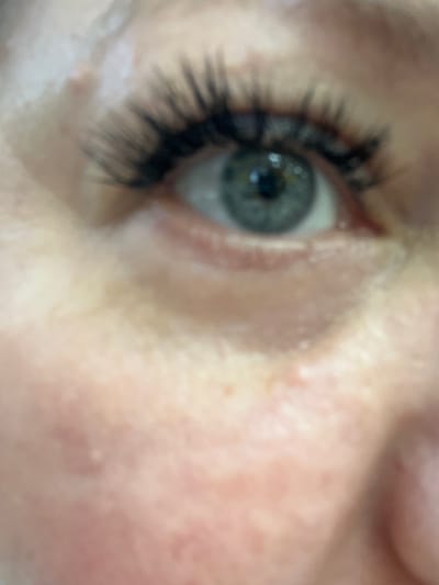 A close-up photographic image displays the left orbital region and adjacent facial integument of an unidentified individual. The subject's eye features a blue-grey iris with a dark, centrally located pupil reflecting a point of light. The upper eyelid is partially visible, from which a dense array of dark, elongated eyelashes originates. The surrounding skin exhibits a fair complexion with diffuse erythema and minor epidermal irregularities, particularly pronounced in the infraorbital and malar areas, which are rendered with significant depth of field blur. The focal plane is primarily centered on the iris, with a general softness evident across the entire image. The depicted scene is located in the city of Сундур, Russia.