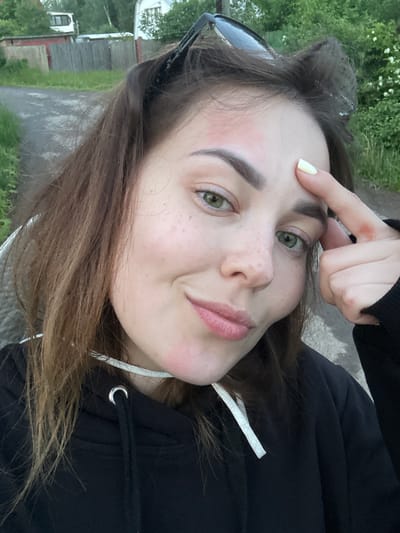 A young woman with light brown hair and green eyes is taking a selfie outdoors. She is wearing a black hoodie with white drawstrings. Her right index finger is touching her forehead, where there is some redness. Her left hand is not visible. Behind her, there is a dirt path, green grass, a wooden fence, and some trees. In the background, a white building and a white vehicle are visible. The image appears to have been taken in Zhebrei, Russia.