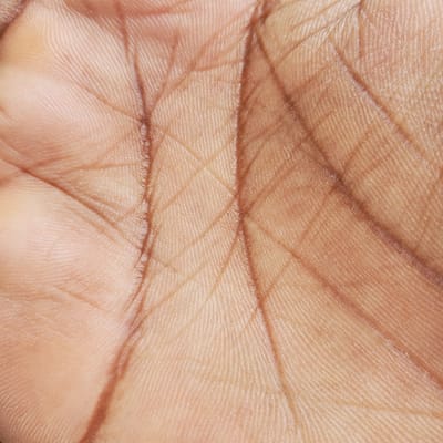 A close-up, high-resolution image depicts the palm of a human hand, specifically focusing on the intricate details of the skin's surface. The subject's skin exhibits a medium to dark brown pigmentation. Prominent palmar creases traverse the visible area, along with numerous finer lines and distinct epidermal ridges (dermatoglyphics) that form complex patterns. The texture of the skin appears consistent with healthy human integument. No other subjects, objects, or environmental context are discernible within the frame, which is entirely filled by the detailed skin surface. The scene is located in Nakuru East ward, Kenya.