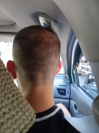 The image shows the back of a person's head and neck as they sit in the passenger seat of a vehicle. The person has short, dark hair and is wearing a black sweater with white stripes around the collar. Their left ear is visible and appears red. The interior of the car is light gray. Through the window, a truck with a white cargo bed is visible on a road. The scene is outdoors, suggesting it is daytime.