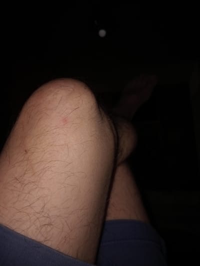 The image shows a close-up view of a person's legs in a dark environment, with the primary focus on the knee and surrounding skin. The skin is lightly tanned and covered with short, light brown hair. There is a small, reddish mark on the knee cap, possibly a scratch or a pimple. The lower part of the image shows a glimpse of dark blue fabric, likely shorts or pants, at the bottom edge. The background is predominantly black, with a faint, out-of-focus circular light source visible in the upper center of the image. The image is taken from a low angle, looking upwards at the legs. The overall scene suggests a casual, indoor setting. The location in Cotiujenii Mari, Moldova, cannot be determined from the visual information provided in the image.