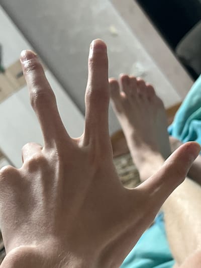 A close-up, low-angle shot focuses on the back of a person's hand and forearm, which is positioned in the foreground. Three fingers are extended upwards: the index, middle, and ring fingers. The index and middle fingers are held together, while the ring finger is slightly separated. The skin on the hand appears fair and slightly oily, with visible veins and knuckles. In the background, out of focus, are a person's bare feet, suggesting they are lying down. A blue cloth is visible in the lower right corner. The environment appears to be indoors, with a neutral-colored wall or ceiling in the upper portion of the frame. There is no visible indication of the city of Gorshki, Russia, within the image.