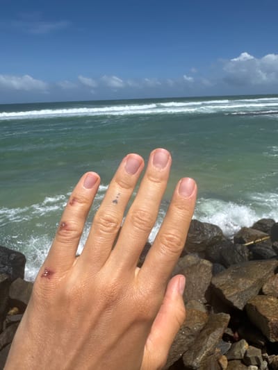 A human hand occupies a significant portion of the foreground, extending from the lower right towards the upper left of the frame. The hand has a light skin tone, and several minor abrasions are visible: a small, reddish cut or scuff at the base of the index finger, another small cut on the side of the middle finger, and three tiny dark dots (possibly a small tattoo or ink marks) on the ring finger. The fingernails are natural and unpolished.

Behind the hand, a vibrant coastal scene unfolds. The ocean, with its greenish-blue waters, is visible across the mid-ground, featuring white-capped waves breaking near what appears to be a shore or rocky boundary. Along the right side and in the bottom right corner, dark, wet rocks are clustered, suggesting a rocky coastline or a breakwater. Above the sea, a clear blue sky with scattered white, fluffy clouds dominates the upper left portion of the image.

The scene is brightly lit, indicating a sunny day, likely mid-day, with clear weather conditions. The presence of the ocean and rocks strongly suggests a coastal location. The image captures a moment by the sea in Walgama, Sri Lanka, consistent with a tropical or sub-tropical beach environment. No text is visible in the image.