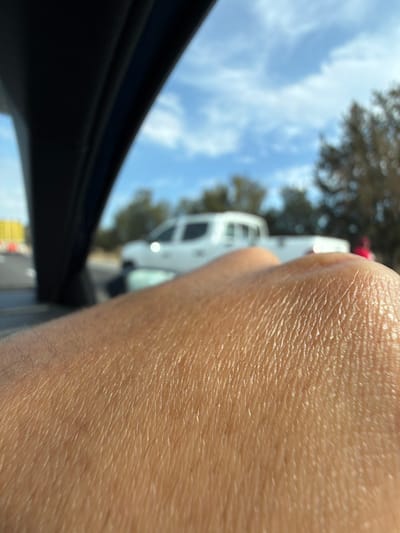 A close-up of tan skin reveals distinct pores and fine hairs. The scene is viewed through a car window, where a white truck, trees, and a partly cloudy sky are visible in the background. The car's window frame appears dark and out of focus. The overall perspective suggests the photo was taken from inside a vehicle.