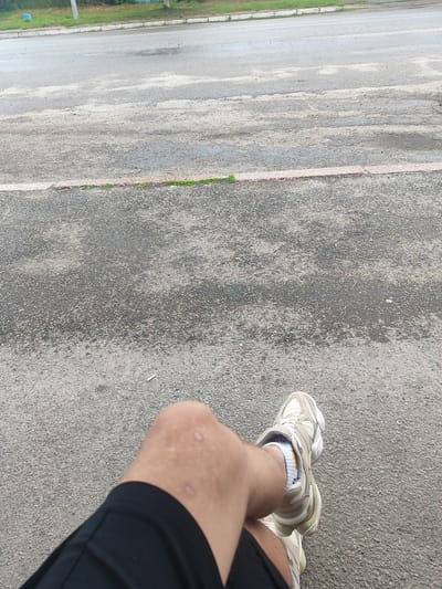 A person's legs and feet are visible, sitting on a paved surface. The person is wearing black shorts and light-colored athletic shoes with white socks. The right leg is bent, with the foot resting on the ground, while the left leg is crossed over the right. The knee of the right leg shows two small, healed wounds. The background consists of a grey asphalt road with some patches and a light-colored curb line. A small patch of green grass is visible along the curb. The scene appears to be outdoors in an urban or suburban environment.
