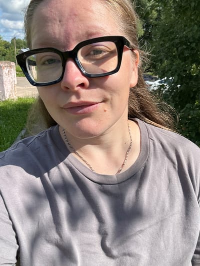 A medium shot portrait shows a Caucasian woman with light skin, wearing large black-rimmed glasses and a grey t-shirt. She has brown hair pulled back and is looking towards the camera with a neutral expression. A thin silver chain necklace is visible around her neck. The background is slightly out of focus, showing a patch of green grass, a light-colored wall with some bricks, a tree with green foliage, and a cloudy sky. The lighting suggests it is daytime, with sunlight casting shadows on the woman's t-shirt. The image appears to be taken outdoors, possibly in a residential area or park within the city of Lotoshino, Russia, given the presence of typical suburban elements like grass, a wall, and trees.