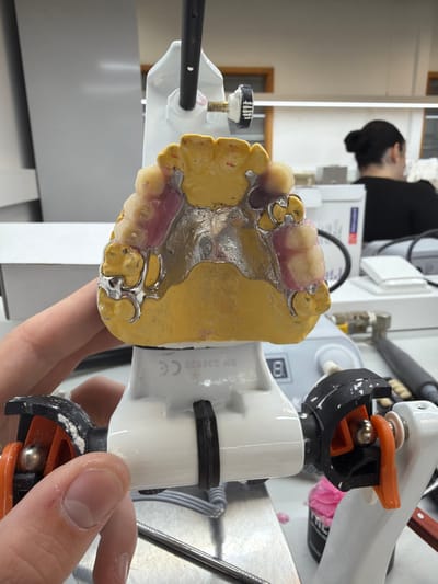 The scene depicts a dental laboratory in Gandra, Portugal. In the foreground, a partially fabricated maxillary dental prosthesis is presented. This prosthesis consists of a yellow dental stone model of the upper jaw, onto which a metallic framework with clasps is affixed. Artificial teeth and pink gingival acrylic are integrated into the framework on both anterior and posterior segments. The prosthesis is mounted on a white, jointed dental articulator or holding device, which displays a "CE" mark and serial number "SM 338820" on its base. A pale-skinned hand grips the lower left section of this device.
In the mid-ground, a workbench is visible, furnished with various dental tools and materials, including white storage containers, a small digital display showing the number "8", and a jar containing a pink substance. Further in the background, a person with dark hair styled in a bun is seated at an additional workbench, facing away from the camera, engaged in an undisclosed activity. The room is illuminated by overhead fluorescent lighting. The environment is consistent with a professional dental technology workshop.