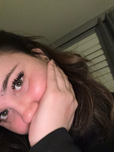 A close-up, tilted portrait of a fair-skinned person with brown hair. The person's hand covers the upper portion of their face, obscuring the forehead and eyes. One eye is visible, exhibiting brown irises and well-defined eyelashes. The nose is also visible, appearing slightly red. The person is wearing a dark-colored, possibly black, garment with a visible sleeve. The background consists of a light green wall and a section of white blinds. There is no information available to determine if the image was taken in Whitby, Canada.