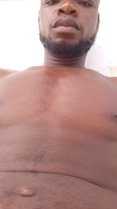 A close-up, chest-up shot features a dark-skinned man with a full, dark beard, looking directly at the camera with a neutral expression. He is shirtless, revealing his chest, shoulders, and upper abdomen. His skin tone is a rich dark brown.
Notable details on his body include visible short, dark hair on his chest and a distinct, raised, light-colored scar or bump on his lower abdomen, below the navel, which appears elongated and somewhat smooth. There are also a few smaller, faint bumps or blemishes visible on his chest. His neck shows slight lines or creases.
The background is a uniformly bright, plain, light-colored surface, possibly a wall, suggesting either an indoor setting with good lighting or an outdoor shot against a light structure. The lighting appears to be natural daylight. The image is likely a selfie, given the close perspective and direct gaze. No activity other than posing for the photograph is depicted. There is no visible text in the image. The location context provided is Agukwu Nri, Nigeria.
