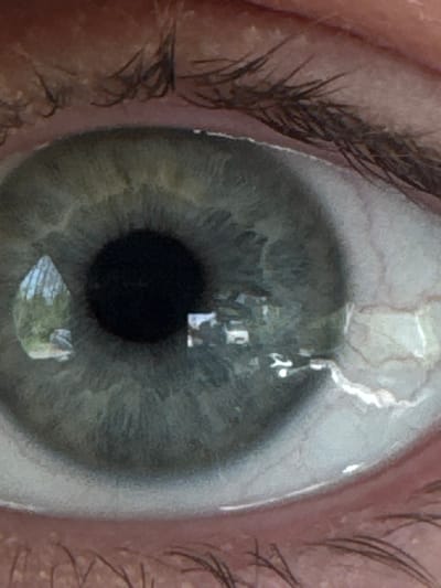 A close-up photograph shows a human eye, with visible eyelashes, iris (gray/green in color), and pupil (black). There are reflections on the surface of the eye. It is impossible to determine the location in the city of Balakhna, Russia from the given image.