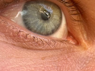 This image presents an extreme close-up of a human eye, depicting a scene presumed to be in Bhagatwadi, India. The subject's left eye features a grey-green iris with a dark, central pupil. The white sclera is partially visible on the upper right and right side of the iris. Dark eyelashes line both the upper and lower eyelid margins, appearing sparser on the lower lid. The surrounding skin, encompassing the lower eyelid and adjacent facial area, exhibits a light complexion with visible fine wrinkles and pores. Two distinct, bright, angular reflections are visible on the corneal surface, indicating a wet eye and reflecting an external light source. No other individuals, objects, actions, or broader environmental details are discernible within the frame.