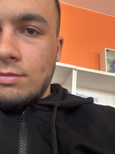 A close-up, angled shot of a person's face and shoulder, likely taken indoors. The person has brown eyes, short dark hair, and a trimmed beard. They are wearing a black hooded sweatshirt. The background includes an orange wall and white shelves, suggesting an interior setting. The location in the city of Lovets, Bulgaria is not visually evident.