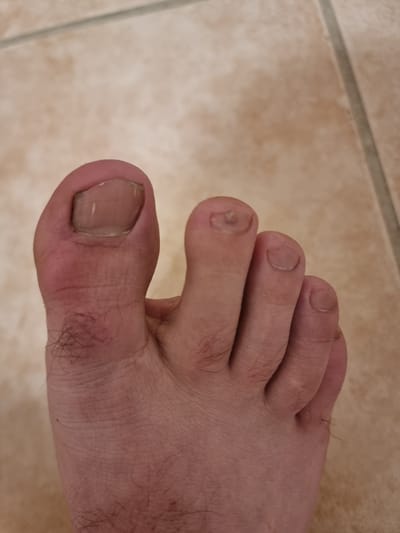 The image shows a close-up view of a person's right foot, specifically the toes, against a background of tiled flooring. The foot exhibits several toes with visible toenails. The skin tone is fair, and there is visible hair growth on the foot, particularly around the base of the toes. The toenails appear somewhat thick and may show signs of natural wear or minor discoloration. The tiling in the background is light-colored with darker grout lines, suggesting an indoor environment, possibly a bathroom or kitchen. The lighting suggests an overhead light source. The overall impression is that of an ordinary, unadorned foot. There is no information present in the image that would allow for the determination of the location within the city of Pohránov, Czechia, or any specific context beyond the visual elements.