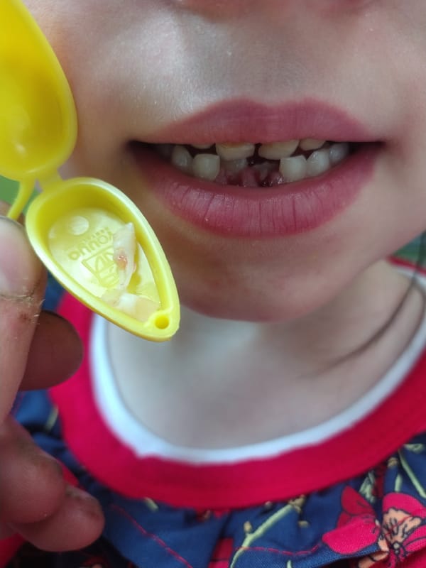 Person plays with yellow toy bird in Luxembourg